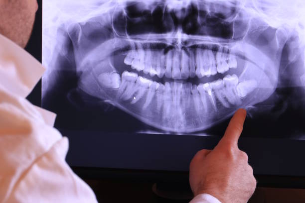 Best Emergency Treatment for Dental Infections or Abscesses in Ashtabula, OH